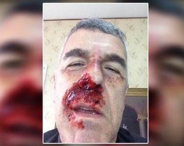 ¿Qué le pasó a Dady Brieva?