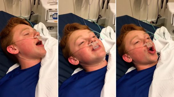 VIDEO: El gracioso despertar de un joven anestesiado que es furor en la web