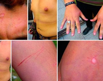 Denuncian a policías por secuestrar y torturar a un militante gay 