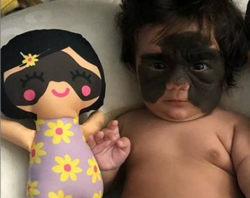 Una bebé se convirtió en estrella de Instagram con su marca de nacimiento