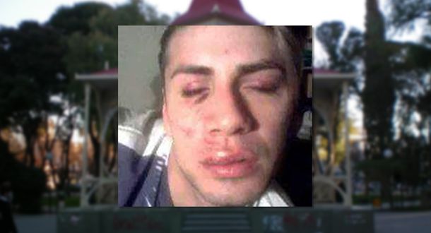 Lo golpearon por ser gay a la salida de un boliche en Trelew