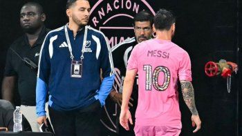 Qué le pasó a Lionel Messi. Qué le pasó a Lionel Messi.