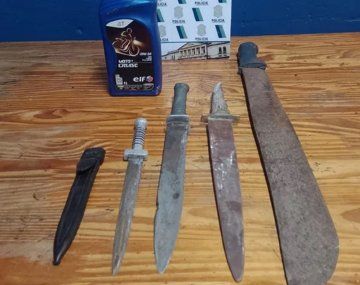 Le pegó a su pareja