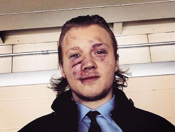 Mirá la brutal pelea en un partido de hockey sobre hielo