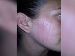 dijo que fue atacada por un fantasma dijo que fue atacada por un fantasma