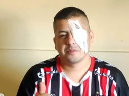 Represión en el Congreso: indagarán al prefecto acusado de dispararle al hincha que perdió la visión