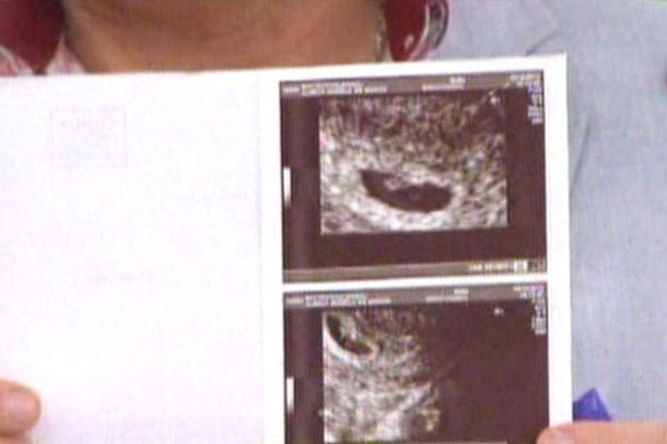 ¿Hay un Fariña Jr.? Magalí Mora mostró su primera ecografía