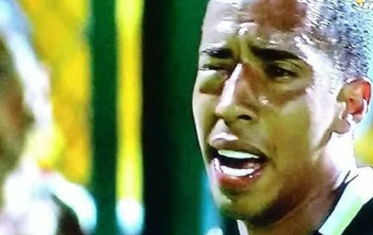 El delantero terminó desfigurado