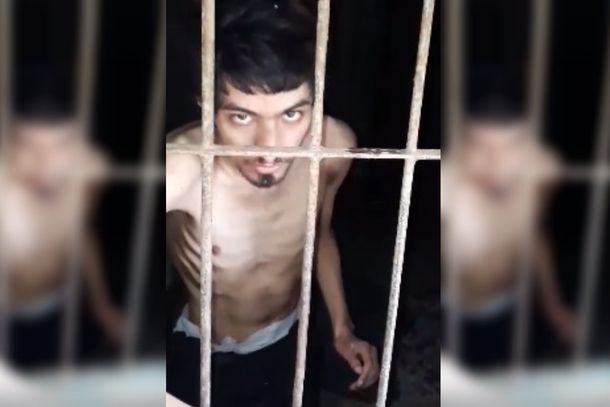 Corrientes: el joven con discapacidad que vivía encerrado y sin comida se recupera en el hospital