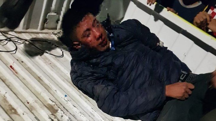 Se cansaron de la inseguridad y le amputaron dos dedos a un presunto ladrón