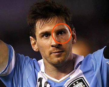 El tremendo golpe que casi le saca un ojo a Lionel Messi