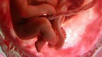 Cordón umbilical Cordón umbilical