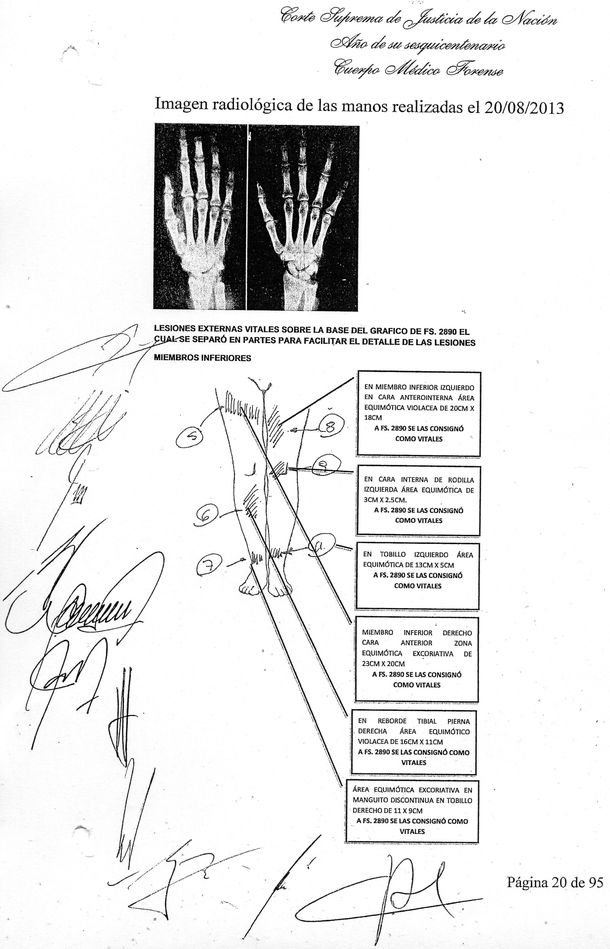 Las lesiones que prueban el abuso a Ángeles Rawson, según la junta médica