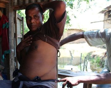 En Bangladesh venden órganos para poder pagar deudas