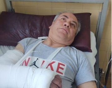 Habló el paparazzi agredido por los guardaespaldas de Margot Robbie y Cara Delevingne