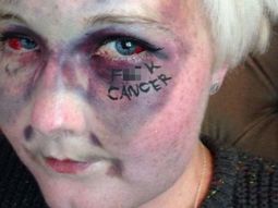 Se saca una impactante selfie para concientizar sobre la enfermedad: mirá la foto