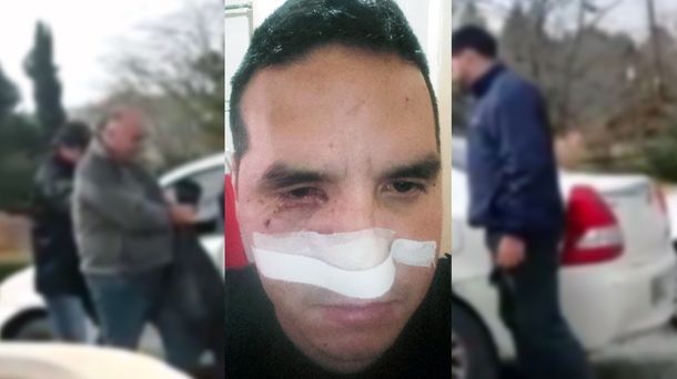 El policía herido tras el operativo en la casa de Jorge Castillo