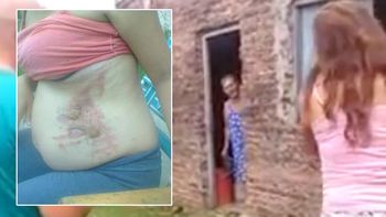 abuela le tiro agua hirviendo a una embarazada abuela le tiro agua hirviendo a una embarazada