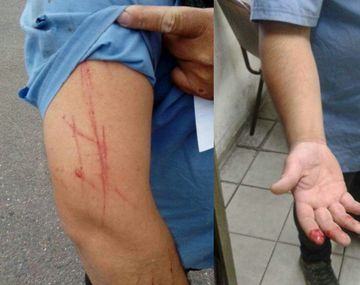 Apuñalaron a un chofer de la línea 169 y los colectiveros lanzaron un paro