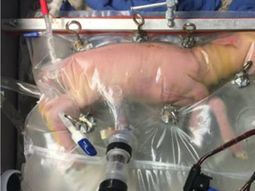 Lograron que el feto se desarrollara en un útero artificial Lograron que el feto se desarrollara en un útero artificial