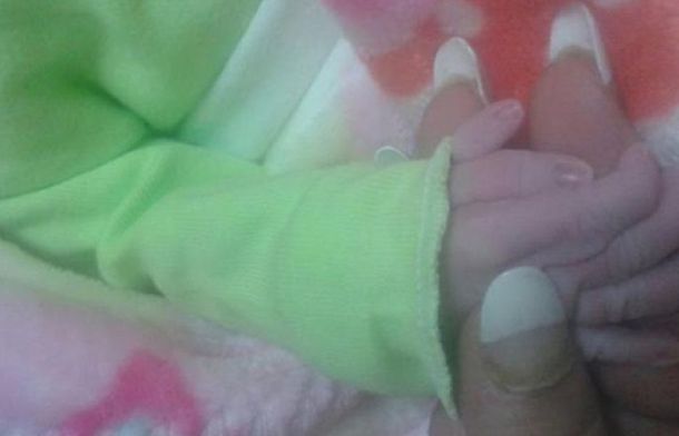 Una beba nació en Tucumán con seis dedos en su mano derecha.