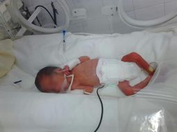 Del dolor a la alegría: la historia del bebé que nació muerto y revivió