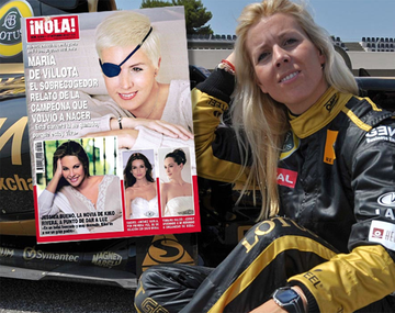 Reapareció la piloto que perdió el ojo en un grave accidente