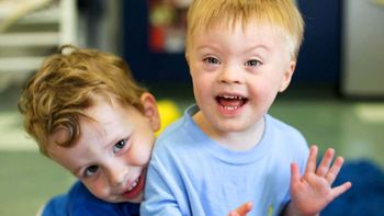 descubren las raices moleculares del sindrome de down descubren las raices moleculares del sindrome de down