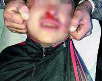 La foto del ladrón linchado por vecinos