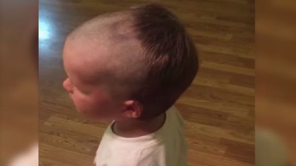 Aprendió de la manera más dura que no debe usar la afeitadora de su papá