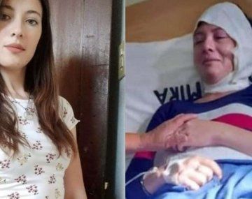 Citó a su ex pareja por la cuota alimentaria y la quemó con aceite hirviendo