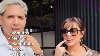 la reini conto sin filtros todas las intervenciones esteticas que se realizo la reini conto sin filtros todas las intervenciones esteticas que se realizo