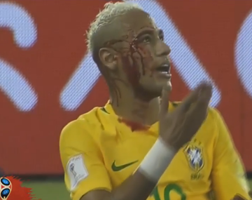 Neymar recibió un codazo en la goleada de Brasil sobre Bolivia.