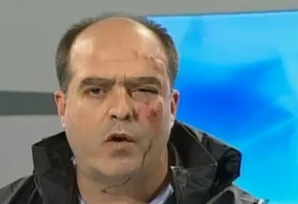 Venezuela: golpean a diputados opositores en la Asamblea Nacional