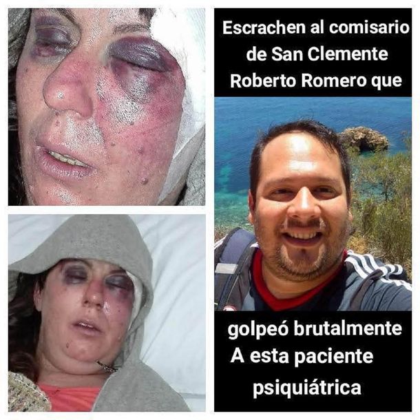 Comisario de San Clemente del Tuyú Roberto Romero acusado de golpear a un paciente psiquiátrica