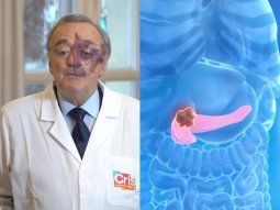 gran hallazgo: una triple terapia abre una nueva esperanza frente al cancer de pancreas gran hallazgo: una triple terapia abre una nueva esperanza frente al cancer de pancreas