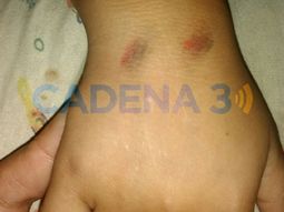 Picanearon a un nene durante el robo en un micro - Crédito:&nbsp;cadena3.com