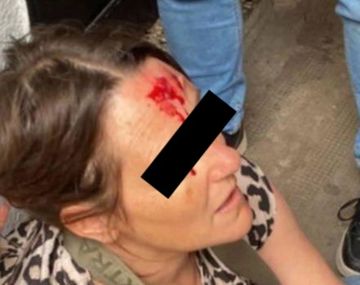 Ataque en un colegio de La Plata: una preceptora terminó herida tras intentar frenar una pelea