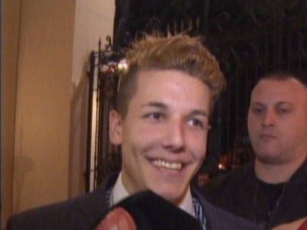 La nueva sonrisa de Alexander