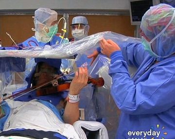 El increíble video en el que un violinista toca su instrumento mientras lo operan del cerebro