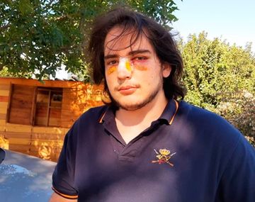 Imputaron a dos rugbiers por la feroz golpiza a un joven en Córdoba