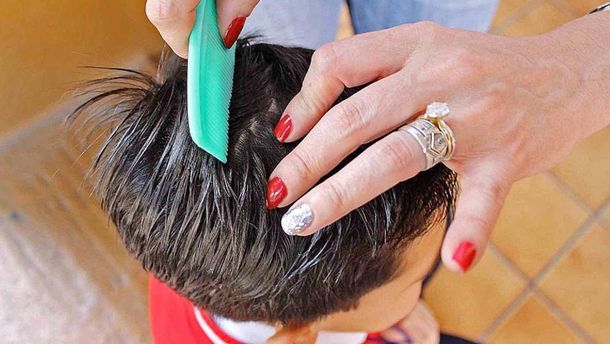 Traer dos piojos vivos, la desagradable tarea que una maestra les dio a sus alumnos