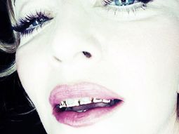 Madonna ahora marca tendencia con sus raras fundas dentales