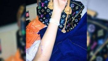 ¿charlotte volvio a someterse a una operacion? ¿charlotte volvio a someterse a una operacion?