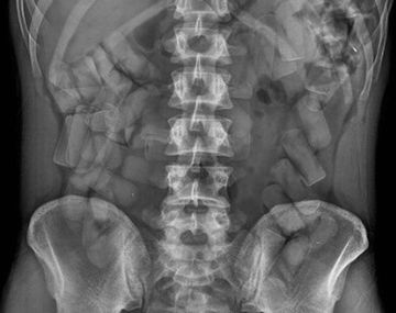 Foto gentileza Carabineros