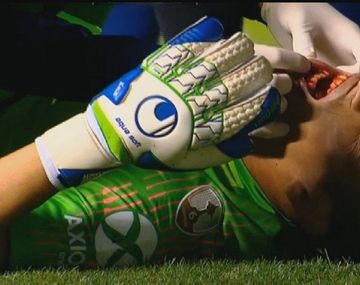 Esteban Andrada sufrió un fuerte golpe en su rostro