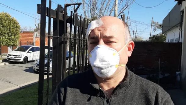 Recibió un disparo a quemarropa. El proyectil quedó alojado en el cuero cabelludo. Foto: Infocielo.