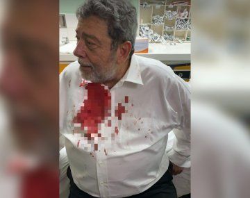 Hieren a un Primer Ministro en una protesta anti vacunación contra el Covid-19