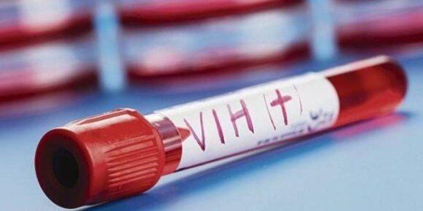 El gran avance que se logró con una vacuna de ARNm en la lucha contra el VIH