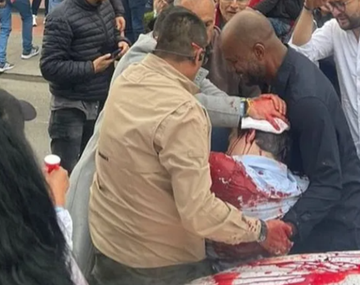 Atentado en Colombia: balean al precandidato presidencial Miguel Uribe